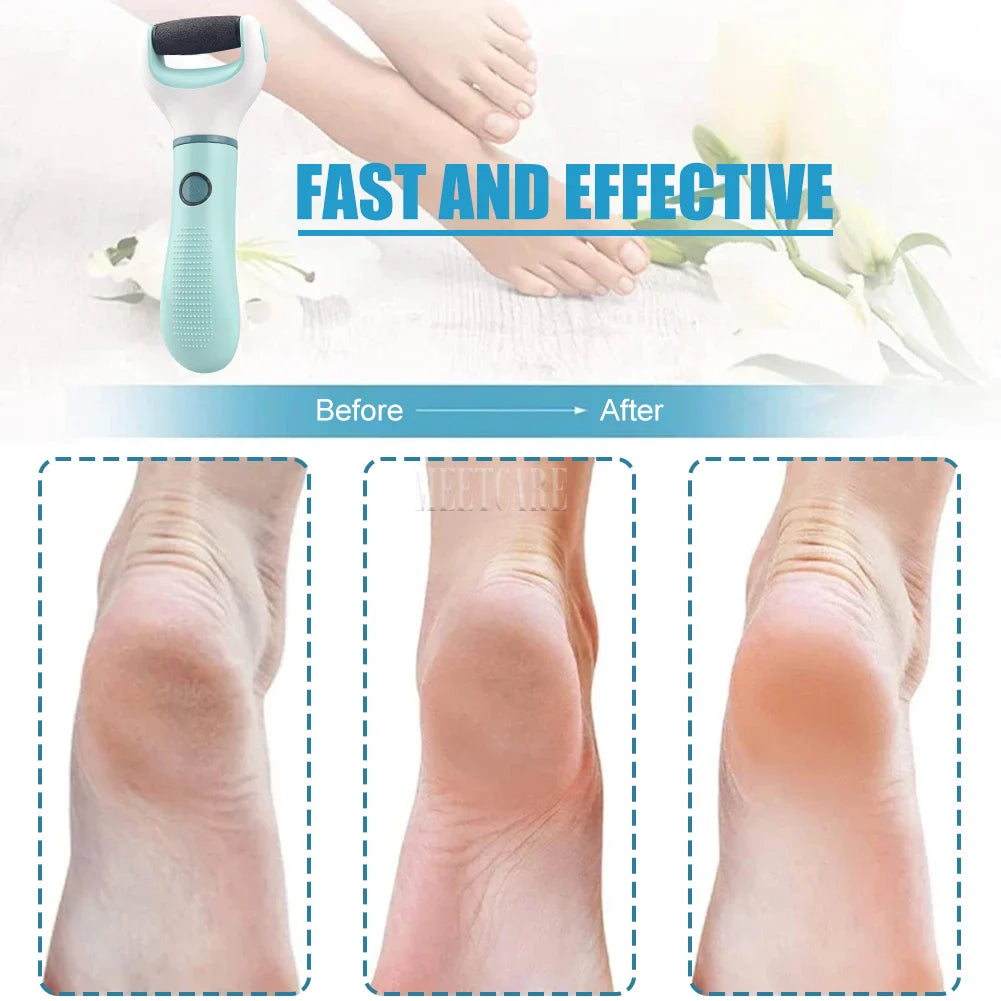 Electric Foot Grinder & Callus Remover — USB Rechargeable, Waterproof Grinding Head